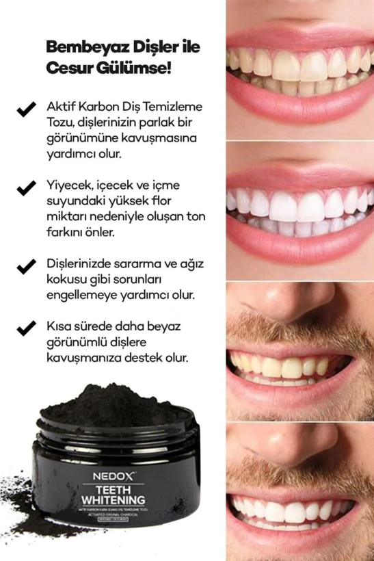پودر سفید کننده دندان با کربن اکتیو دیاموند سیاه NEDOX 75 گرم