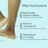 بهترین کرم ترک پا خارجی