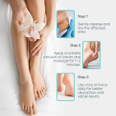 بهترین کرم ترک پا خارجی