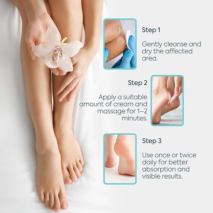 بهترین کرم ترک پا خارجی